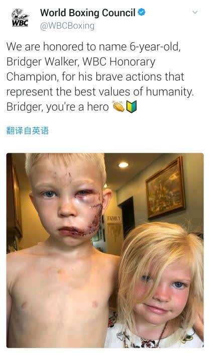 为救妹妹缝90针男孩获得金腰带 表彰他的勇敢行为