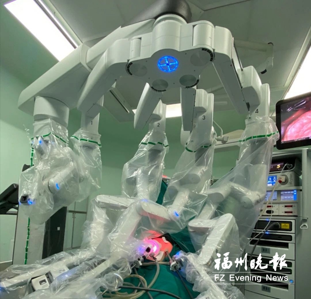 福建首台儿外科机器人手术进行 对象是一岁半小女孩